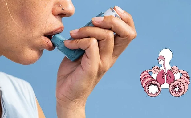 Asthma relief medicines for breathing support and airway inflammation control